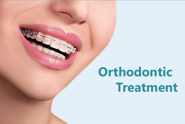 Orthodontic Treatment